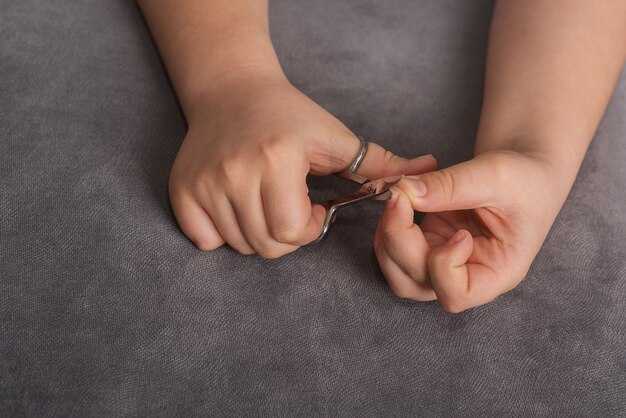 Народные средства для снятия воспаления в домашних условиях