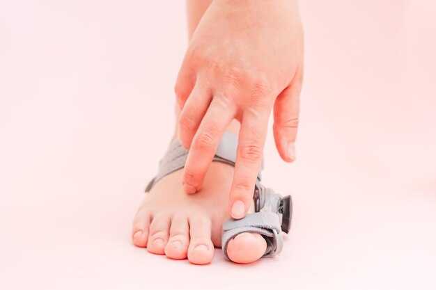 Что делать при подозрении на перелом