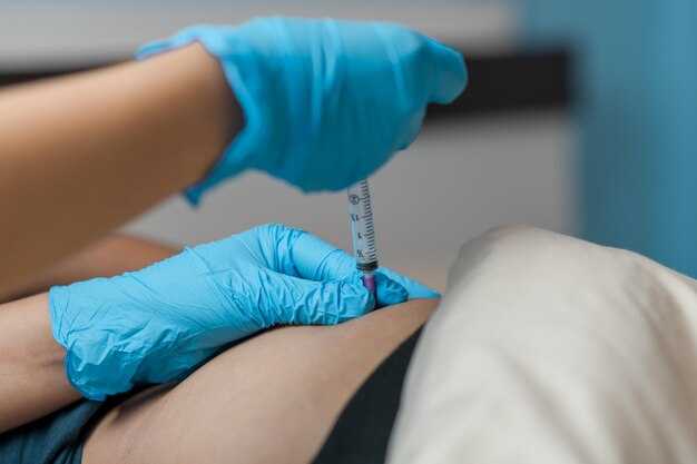 Правильная техника введения иглы