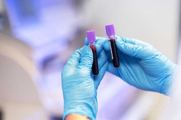 Что такое общий анализ крови и зачем он нужен