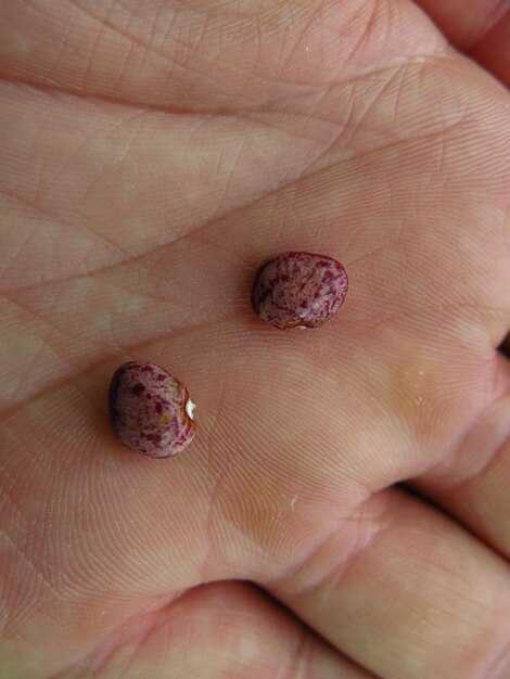 Как защитить кожу от меланомы в будущем