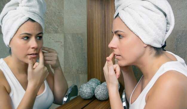 Как правильно выдавливать угри без вреда коже