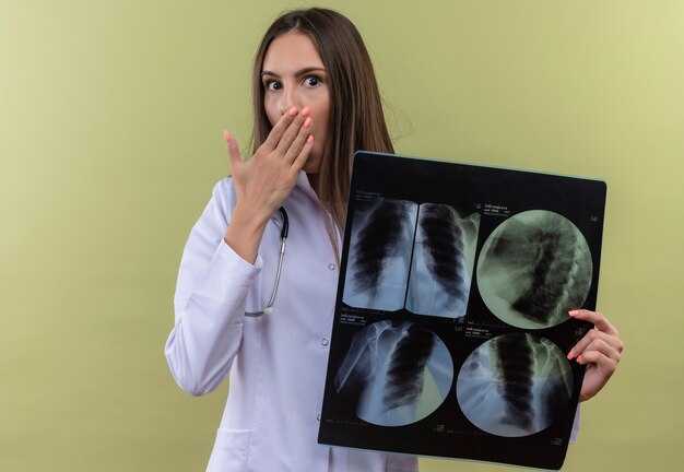 Что значит положительная реакция Манту