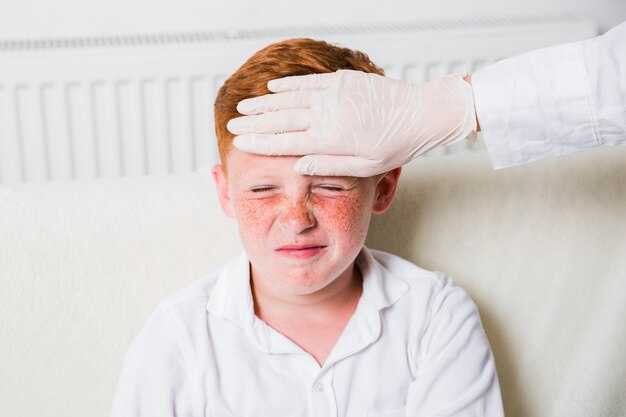 Первичные проявления сыпи: как выглядит