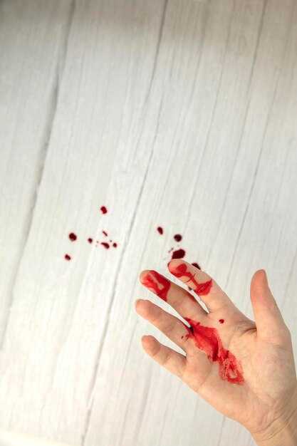 Капиллярное кровотечение: что нужно знать