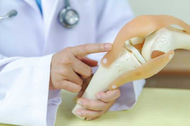 Советы по выбору спортивной обуви для колена