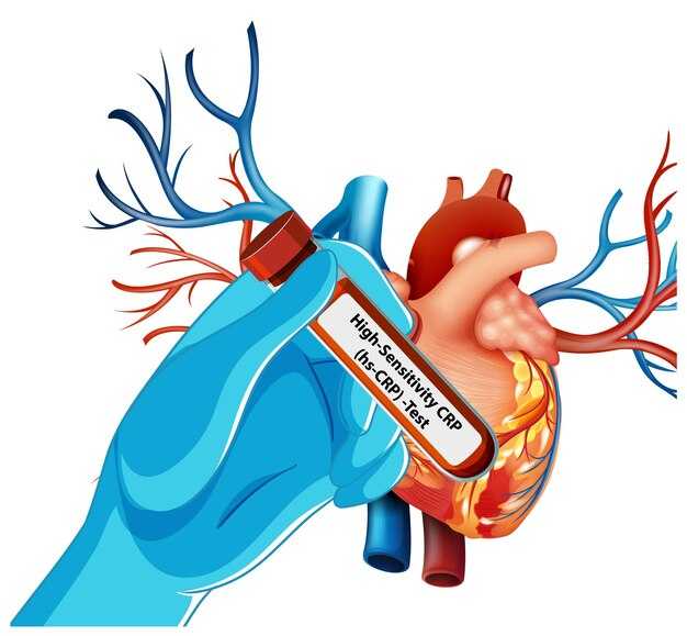 Заболевания, связанные с легочными артериями