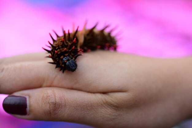 Начало развития меланомы: первые признаки