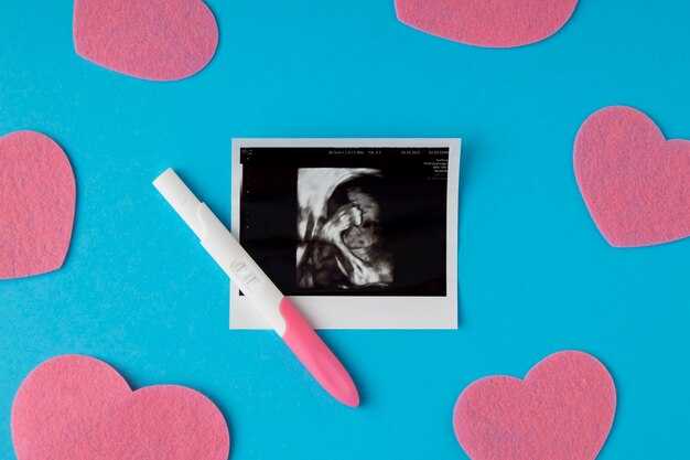 Сроки беременности и их определение