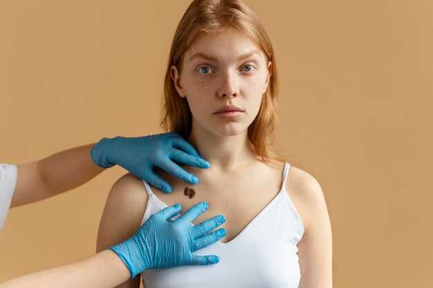 Влияние внешних факторов на цвет бородавки