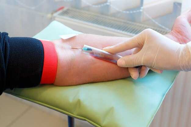 Состояние венозной сети пациента