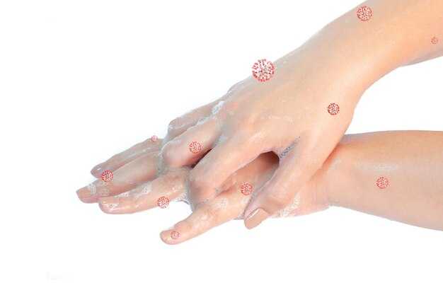 Разновидности псориаза и их проявления на руках