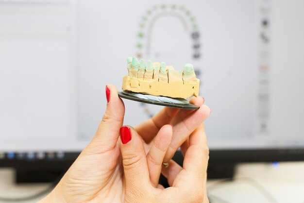 Выбор материалов для протезов