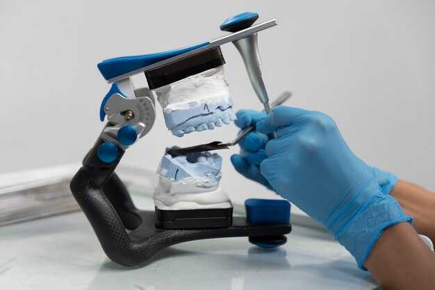 Уход за зубными имплантами после процедуры