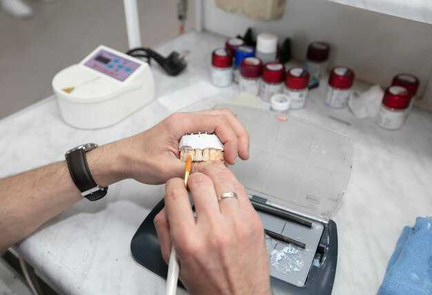 Выбор подходящего типа зубных имплантов