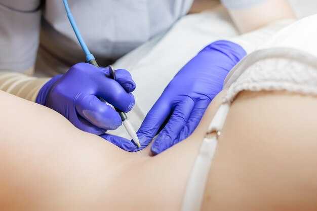 Методы дезинфекции кожи перед уколом