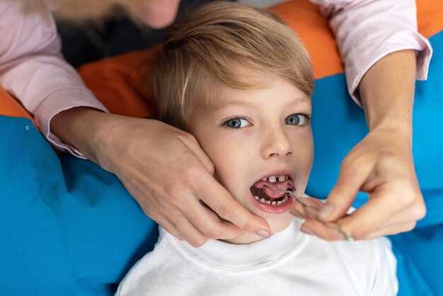 Как диагностировать волчью пасть у ребенка